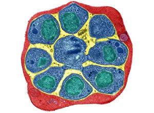 Microorganisms Prints: RBC Infected with Malarial Parasite, TEM
