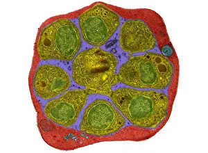 Pathogen Prints: RBC Infected with Malarial Parasite, TEM