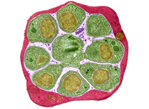 Protist Prints: Red blood cell Infected with Malarial Parasite