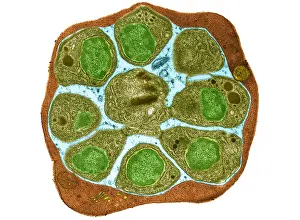 Protist Prints: red Blood Cell (RBC) Infected with Malarial Parasite