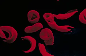 Hemoglobin Prints: Red blood cells