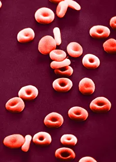 Red Blood Cells, under a microscope (SEM)