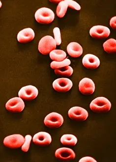 Histology Prints: Red Blood Cells, under a microscope (SEM)
