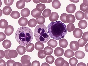 Micrograph Prints: Red and White Blood Cells, light micrograph