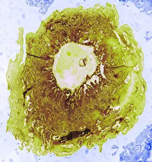 Mammalian Prints: Reproduction System, Human Ovum, TEM