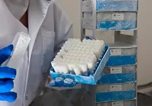Research Prints: Researcher with Human Tissue Samples