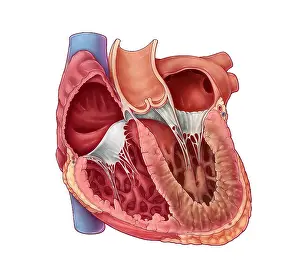 Cardiovascular Prints: Restrictive Cardiomyopathy