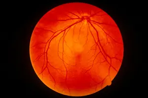 Normal Prints: Retina