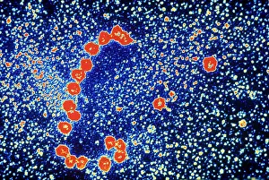 Expression Prints: Ribosomes, mRNA, Protein Production, TEM