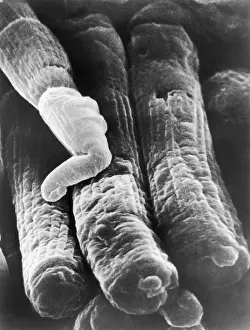 Retina Prints: Rods and Cones, under a microscope (SEM)