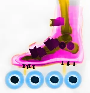 January Prints: Rollerbade, Foot, X-Ray