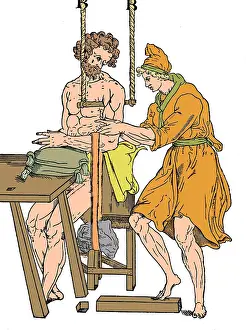 Joint Prints: Roman Devices for Setting Fractures