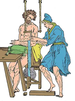 Medical Prints: Roman Devices for Setting Fractures