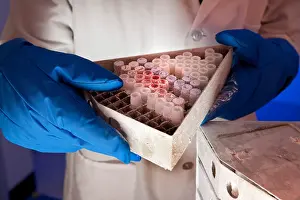 Research Prints: Samples Stored in Liquid Nitrogen