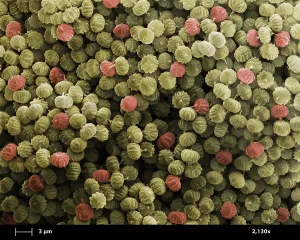 Pathogen Prints: SEM of Ergot