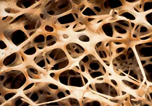Musculoskeletal Prints: Shin Connecting Bones SEM