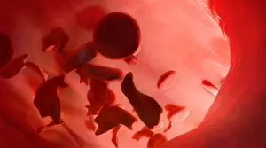 Flow Prints: Sickle-cell Disease Illustration