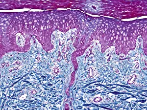 Micrograph Prints: Skin, light micrograph