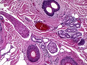 Micrograph Prints: Skin, light micrograph