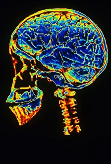 Profile Prints: Skull With Brain