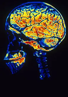 Profile Prints: Skull With Brain