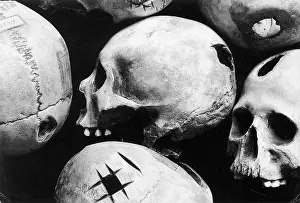 Operating Prints: Skulls Showing Trepanation