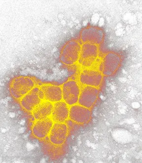 Viruses Prints: Smallpox virus