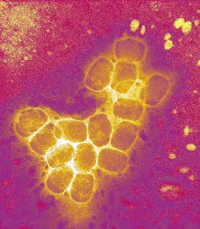 Virus Prints: Smallpox virus