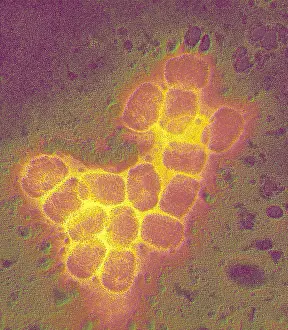 Virus Prints: Smallpox virus