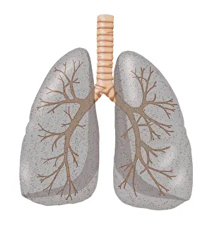 Smoker's Lungs