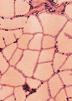 Contract Prints: Smooth Muscle, Phasic, TEM