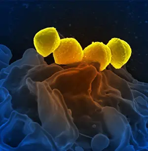: Streptococcus pyogenes Bacteria, under a microscope (SEM)