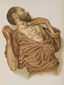 Form Prints: Suicide Through Stabbing, 1898