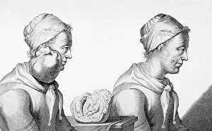 Patient Prints: Surgical Removal of Tumor, 1689