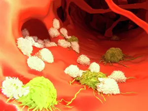 Pathological Prints: T-lymphocytes and cancer cells, artwork