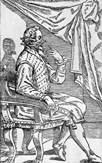 16th Prints: One of Tagliacozzi's Rhinoplasty Methods, 5 of 6