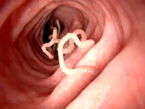 Monster Prints: Tapeworm in human intestine
