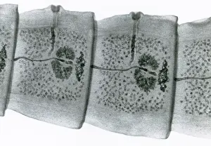 Segment Prints: Tapeworm (Taenia sp.) under a microscope
