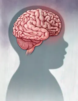 2016 Prints: Tay-sachs Disease, Brain Anatomy