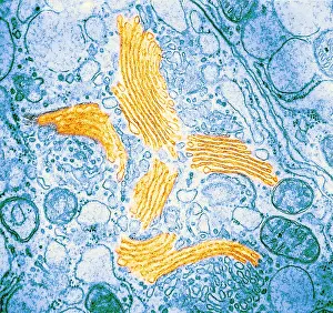 Eukaryotic Prints: TEM of Golgi Bodies
