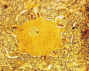 Tems Prints: TEM of Negri Body