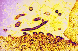 Virus Prints: TEM of Respiratory Syncytial Virus