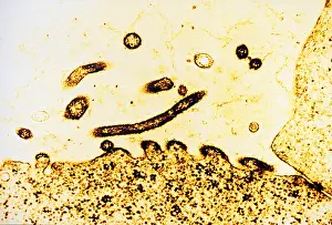 Virus Prints: TEM of Respiratory Syncytial Virus