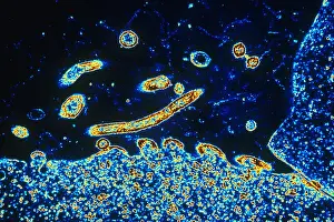 Virus Prints: TEM of Respiratory Syncytial Virus