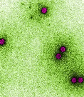 September Prints: TEM of Rhinoviruses