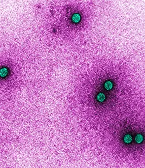 September Prints: TEM of Rhinoviruses