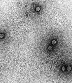 2010 Prints: TEM of Rhinoviruses