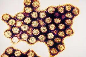 Tems Prints: TEM of Rotavirus