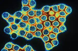 Virus Prints: TEM of Rotavirus