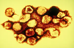 Tems Prints: TEM of Rubella (German Measles)